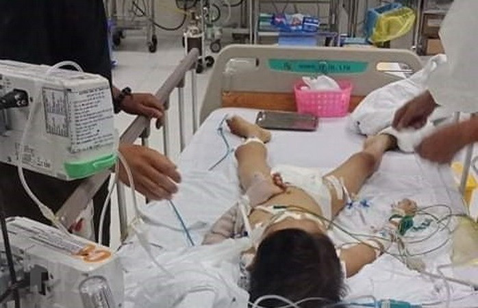 Bé Công được cấp cứu tại bệnh viện Nhi Đồng 2 trong tình trạng hôn mê sâu, nguy kịch. (Ảnh: TTXVN).