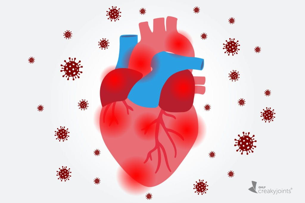 COVID-19 có thể để lại nhiều di chứng trên hệ thống tim mạch.