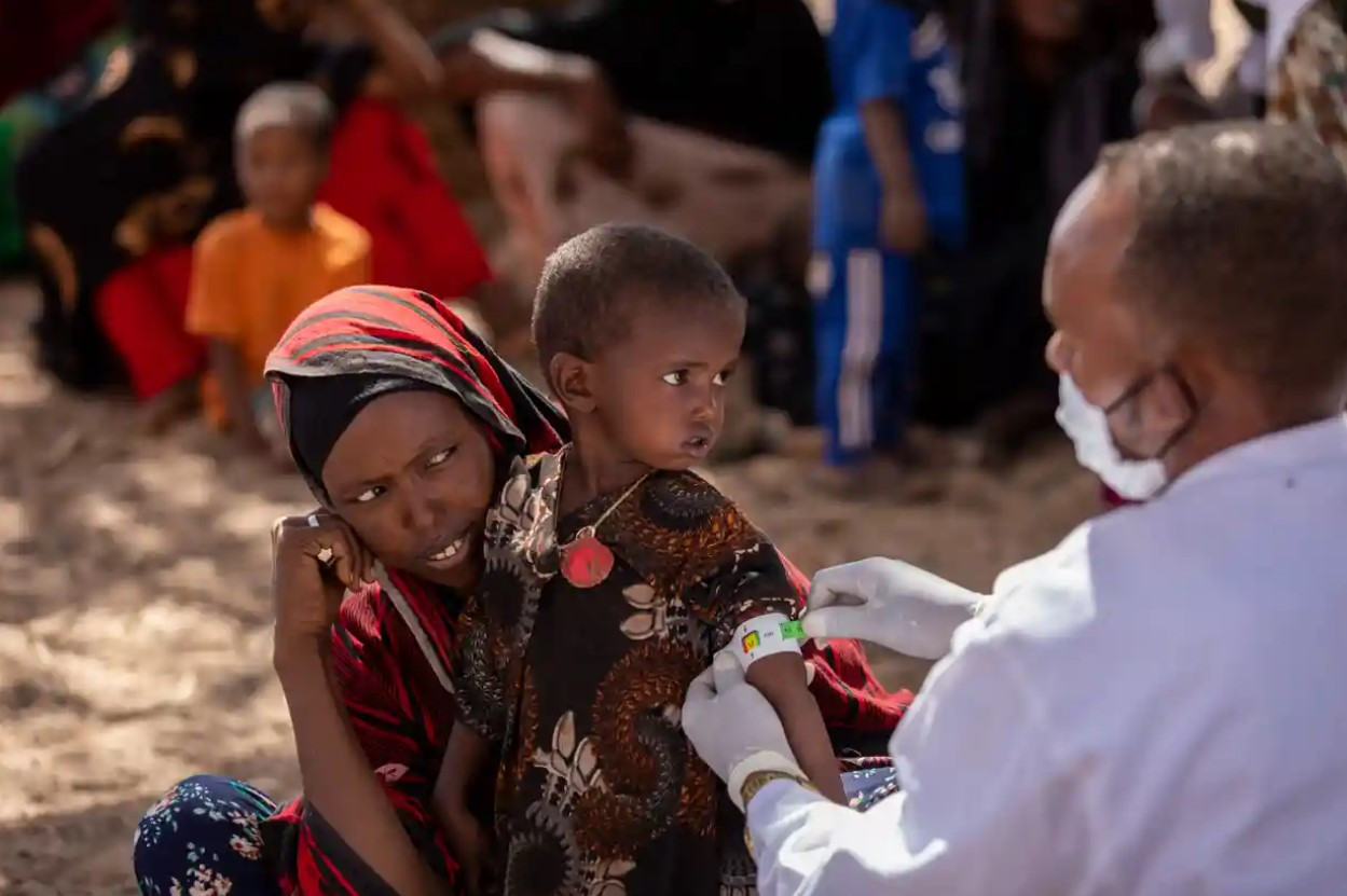 Những đứa trẻ bị suy dinh dưỡng ở Ethiopia. Ảnh: UNICEF.
