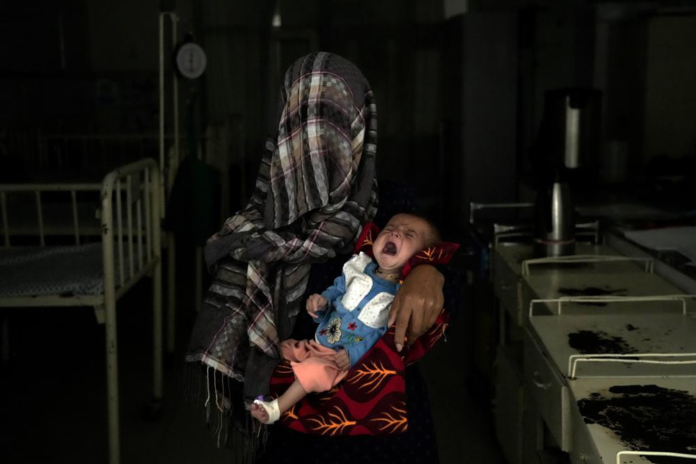 Những đứa trẻ suy dinh dưỡng nghiêm trọng ở Afghanistan. Ảnh: AP.