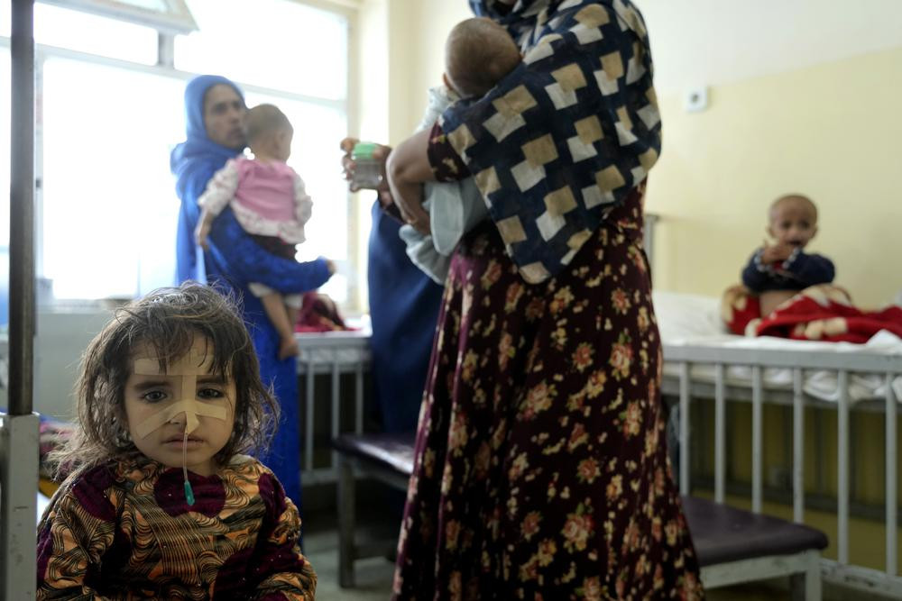 Ngày càng nhiều trẻ em suy dinh dưỡng nghiêm trọng ở Afghanistan. Ảnh: AP.
