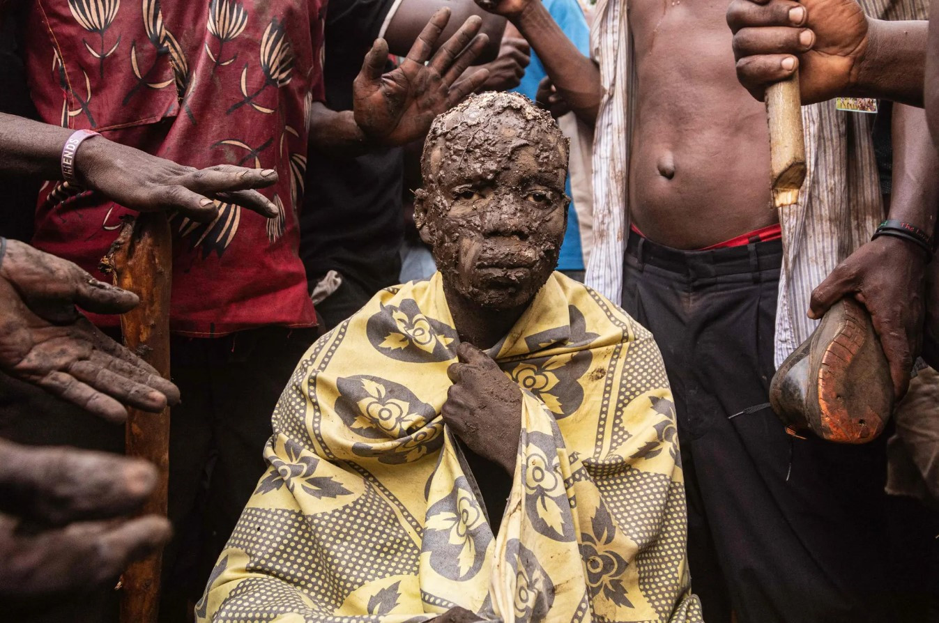 Một đồng tu phản ứng sau khi bị cắt bao quy đầu trong truyền thống Imbalu ở Mutoto. Ảnh: Badru Katumba / AFP / Getty Images.