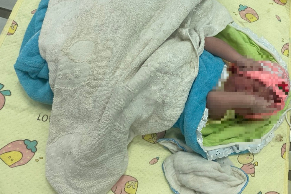 Cháu bé chưa cắt dây rốn bị bỏ lại ở Khoa Nhi, Bệnh viện Đa khoa tỉnh Quảng Trị. Ảnh: ND.