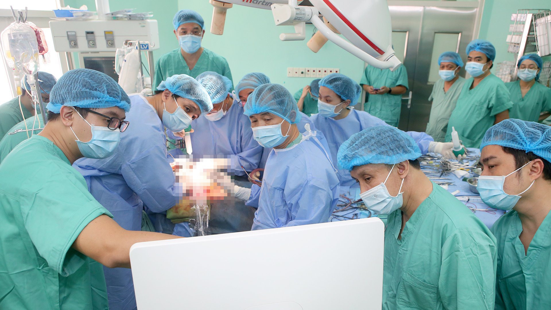 Bệnh viện Trung ương Huế 'lập 3 kỷ lục' về ghép tạng