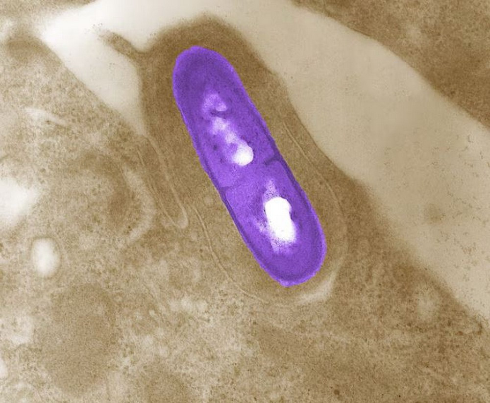 Vi khuẩn Listeria. (Ảnh: Reuters)