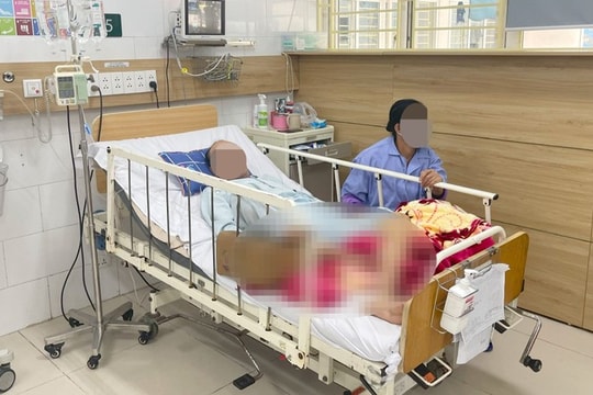 Nguy cơ dị ứng nặng khi sử dụng thuốc nam